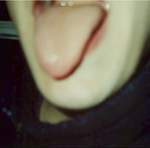 Marks tongue