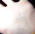 DCP 0332