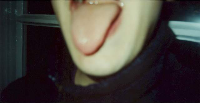 Marks tongue