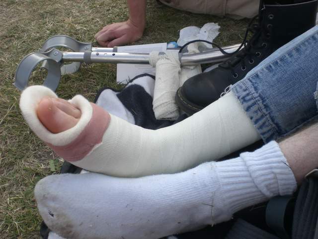Foot of death