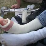 Foot of death